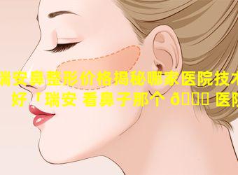 瑞安鼻整形价格揭秘哪家医院技术好「瑞安 看鼻子那个 🐎 医院好」